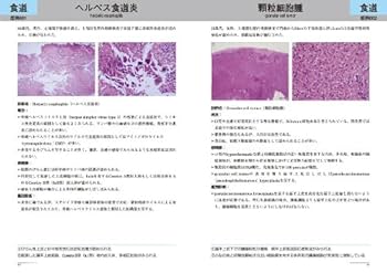 病理医・臨床医のための病理診断アトラス : \"彩の国さいたま\"病理診断セミナー… 病理医・臨床医のための病理診断アトラス : 